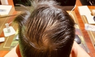 新浪20岁生日 微博CEO晒后脑勺照片：头开始秃了